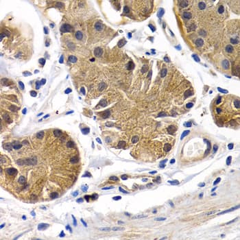 PTGIR / IP Receptor Antibody