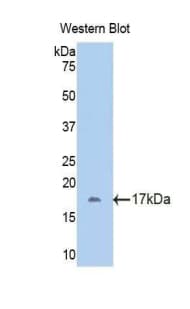 FETUB / Fetuin B Antibody (aa179-295)