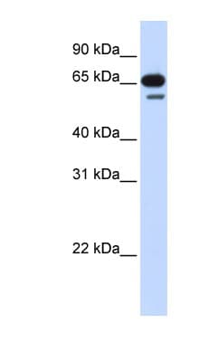 Polyclonal Rabbit anti-Human R3HDM2 Antibody (aa828-877, WB)