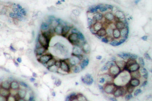 Polyclonal Rabbit anti-Human GAP43 Antibody (Ala35, IHC)