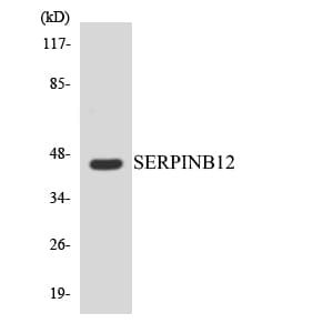 SERPINB12 Antibody (aa231-280)