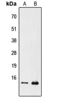 PFDN1 Antibody (N-Terminus)