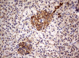 PIK3CD / PI3K Delta Antibody (aa286-610, clone OTI1D11)