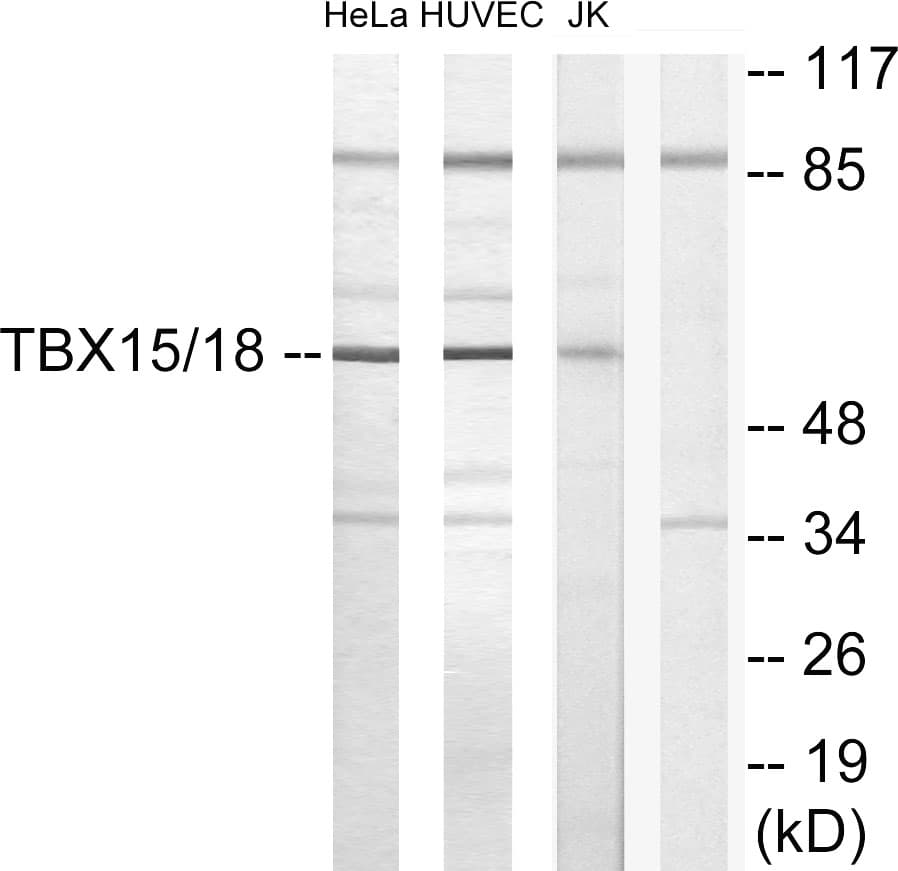 TBX15+18 Antibody (Internal)
