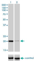 Monoclonal Mouse anti-Human CETN3 Antibody (clone 3E6, WB)