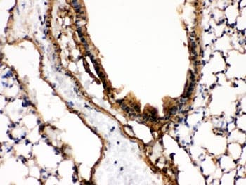 MAP2K7 / MEK7 Antibody