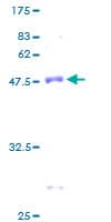 Human NDUFS4 Protein (Recombinant GST)