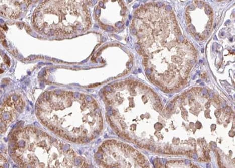 MRRF Antibody