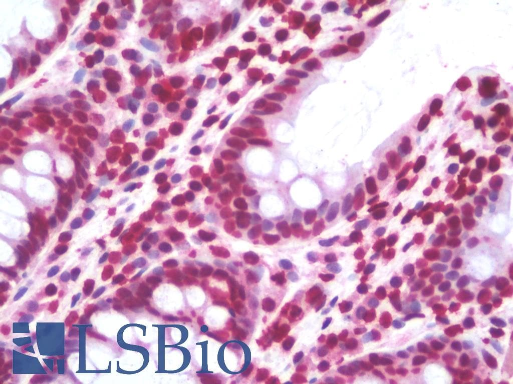 IHC-plus™ Monoclonal Mouse anti-Human ZIC4 Antibody (clone 2B9, IHC, WB)