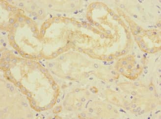Polyclonal Rabbit anti-Human CRLF2 / TSLPR Antibody (IHC)