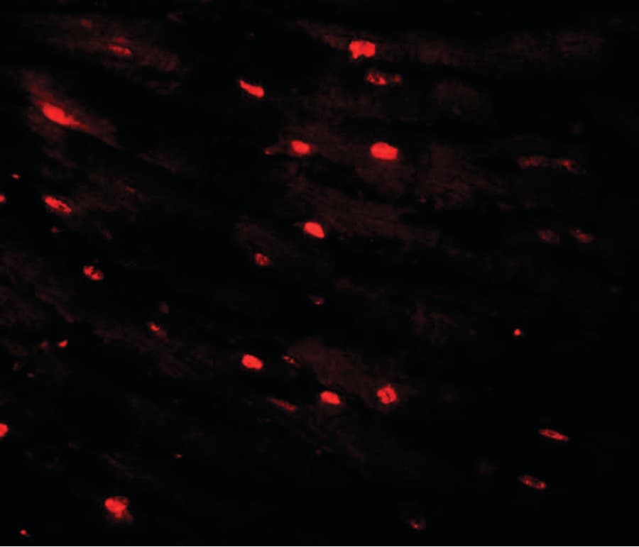 IHC-plus™ MTUS2 Antibody