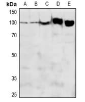 Polyclonal Rabbit anti-Human ADAM12 Antibody (WB)