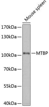 MTBP / Mdm2-Binding Protein Antibody