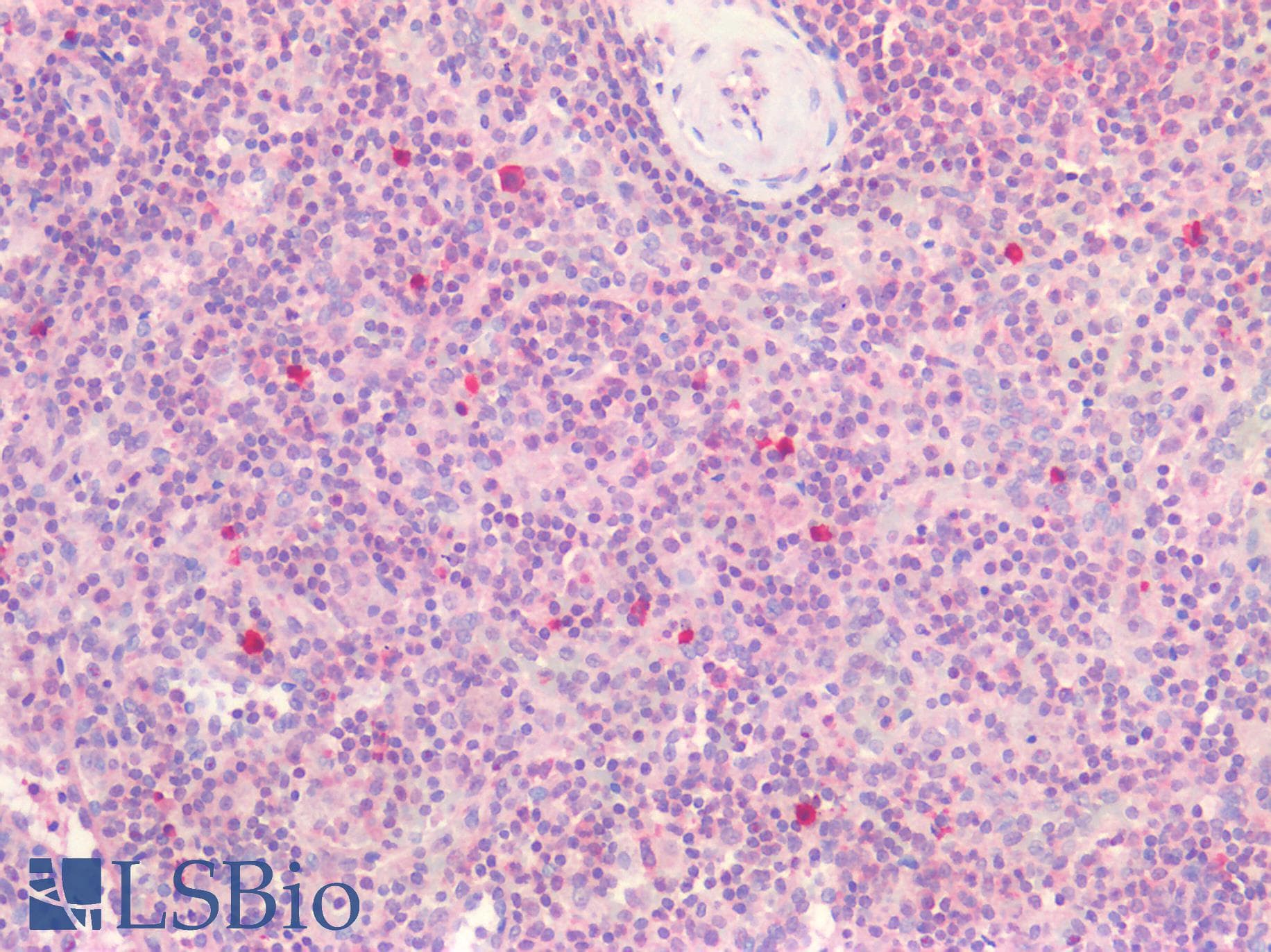 IHC-plus™ Polyclonal Rabbit anti-Human IL23A / IL-23 p19 Antibody (IHC)