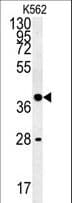 WNT8B / Wnt 8b Antibody (aa323-351)