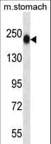 TNN / Tenascin N Antibody (aa587-615)