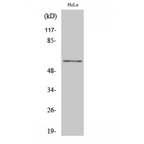 GK2 / Glycerol Kinase 2 Antibody (250-330 aa, Internal)