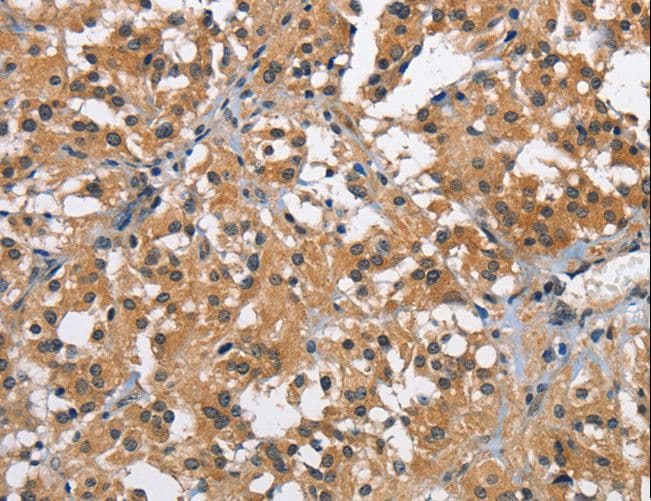 Polyclonal Rabbit anti-Human BRCC45 / BRE Antibody (IHC, WB)