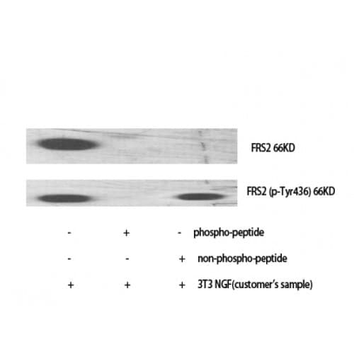 FRS2 Antibody (140-220 aa)