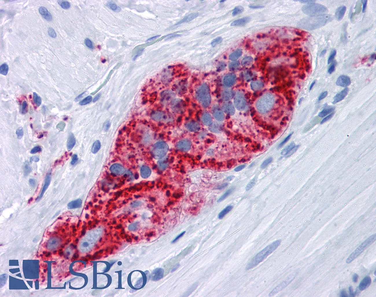 PathPlus™ SYP / Synaptophysin Antibody (clone 7H12)