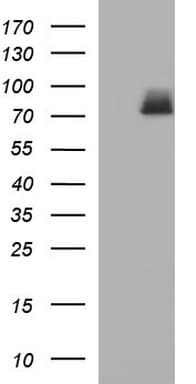HSD17B4 Antibody (clone OTI2C9)