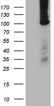 TTC7A Antibody (aa1-450, clone OTI4A2)