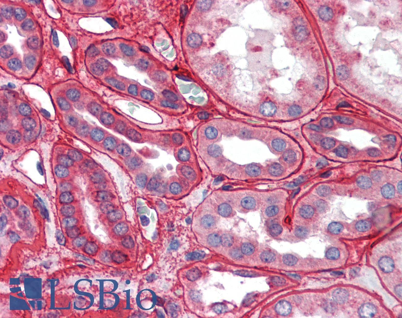 IHC-plus™ Polyclonal Rabbit anti-Mammal Collagen IV Antibody (IHC, WB)