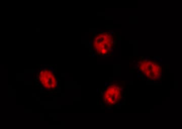 CTDSP1 / SCP1 Antibody