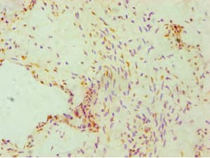 FKBP4 / FKBP52 Antibody (aa220-459)
