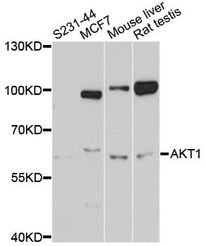 Polyclonal Rabbit anti-Human AKT1 Antibody (IHC, IF, WB)