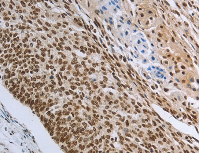 PRMT3 Antibody