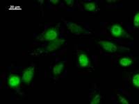 ZNF384 Antibody (clone 3545C5a)