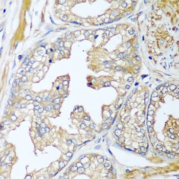 IHC-plus™ CFD / Factor D / Adipsin Antibody