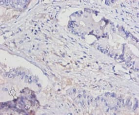 IL15 Antibody