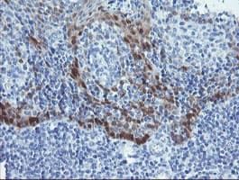 ADH7 Antibody (clone OTI2H10)