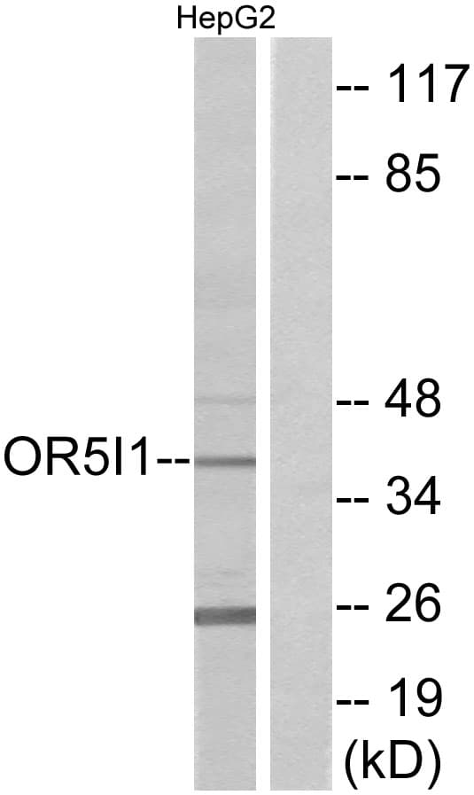 OR5I1 / OR5I Antibody (aa206-255)