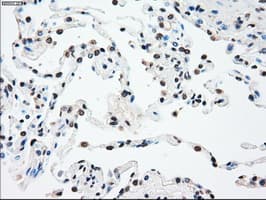 SSB / La Antibody (clone OTI3H9)