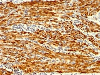 CNN1 / Calponin Antibody (clone SPM169)