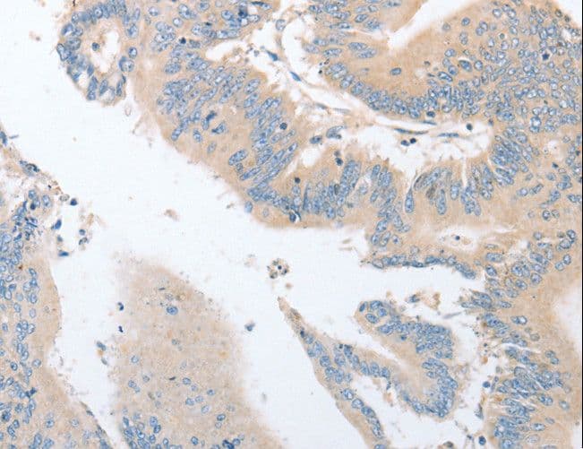Polyclonal Rabbit anti-Human EPS15L1 / EPS15R Antibody (IHC, WB)