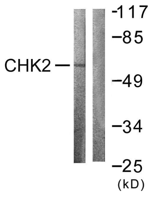 CHEK2 / CHK2 Antibody (aa356-405)