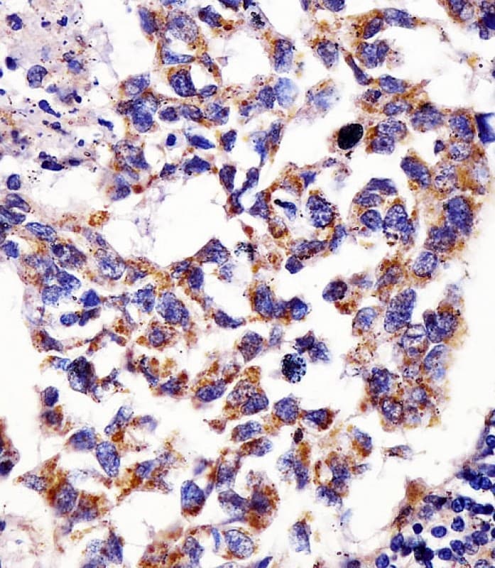 HSPD1 / HSP60 Antibody