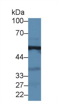 GPT / Alanine Transaminase Antibody (aa147-263, APC, Cy7)