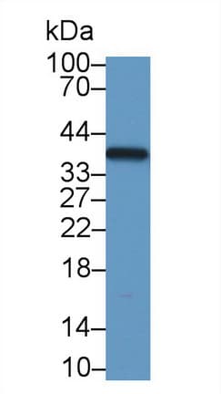 LDHB / Lactate Dehydrogenase B Antibody (aa1-334)