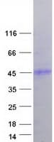 Human HFE Protein (Recombinant Myc-DDK (Flag))