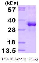 Human RPS3 / Ribosomal Protein S3 (Recombinant His)