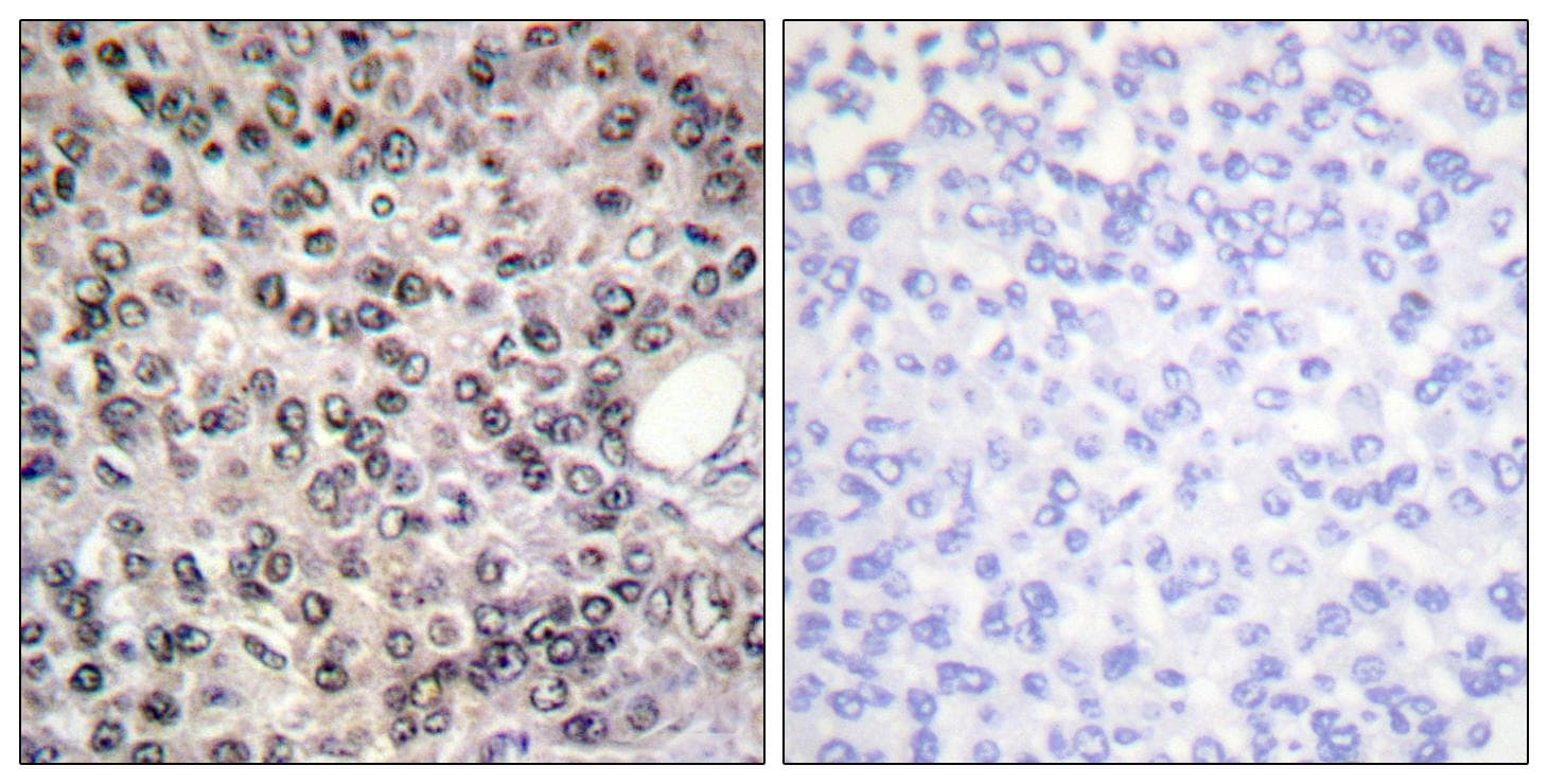 DDX5 Antibody (phospho-Tyr593)