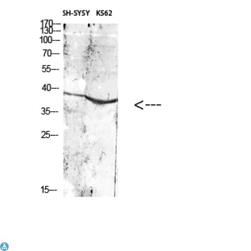 ART1 /CD296 Antibody