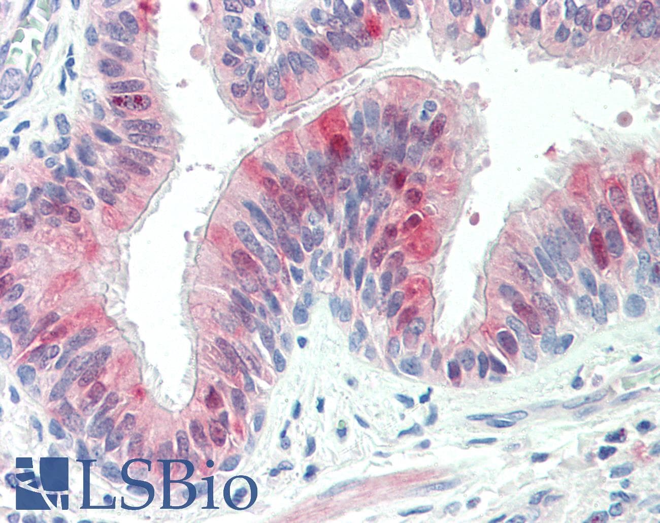IHC-plus™ ZDHHC13 / HIP14L Antibody (aa611-622)