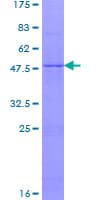 Human NDUFS7 Protein (Recombinant GST)