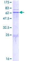 Human ST3GAL1 Protein (Recombinant GST)